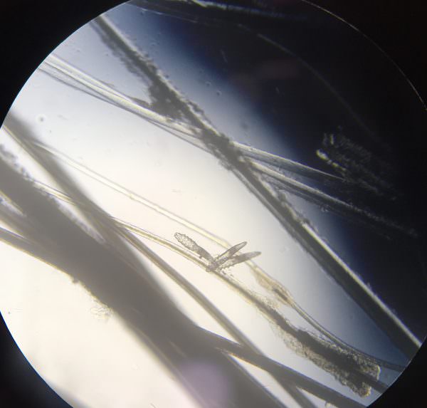 sarna-demodecica-microscopio