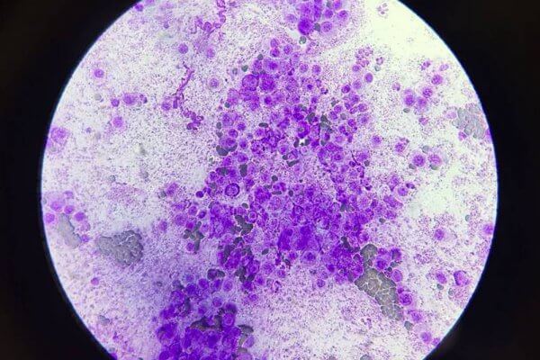 mastocitoma canino 1